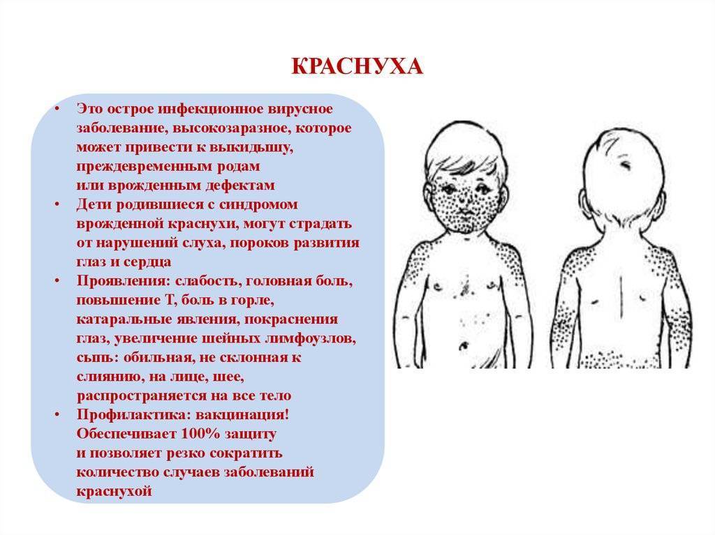 Краснуха у детей: симптомы, лечение, профилактика, видео