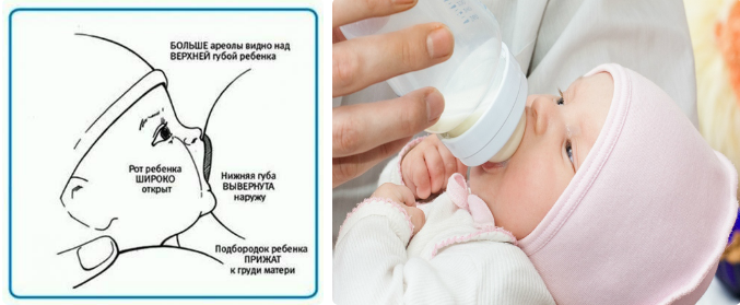 Боли в животе у детей