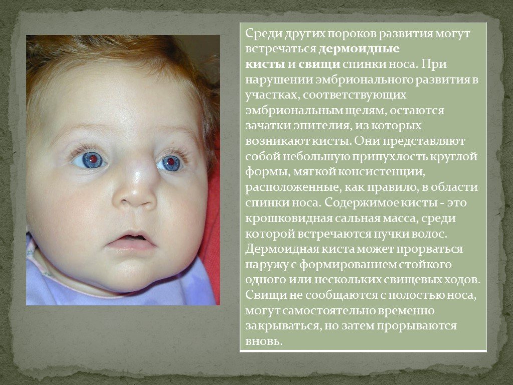 Почему у ребенка желтый нос до года: причины и рекомендации