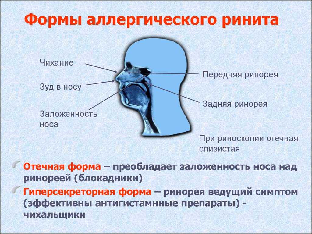 Частый насморк у ребенка: кто виноват и что делать?