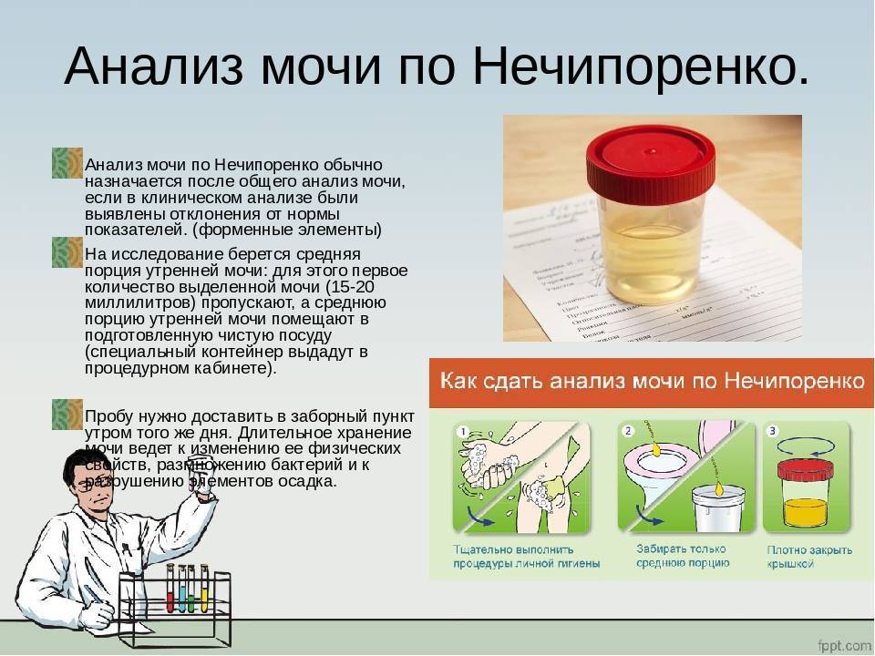 Как собирать мочу у грудничка, сколько мл нужно для анализа