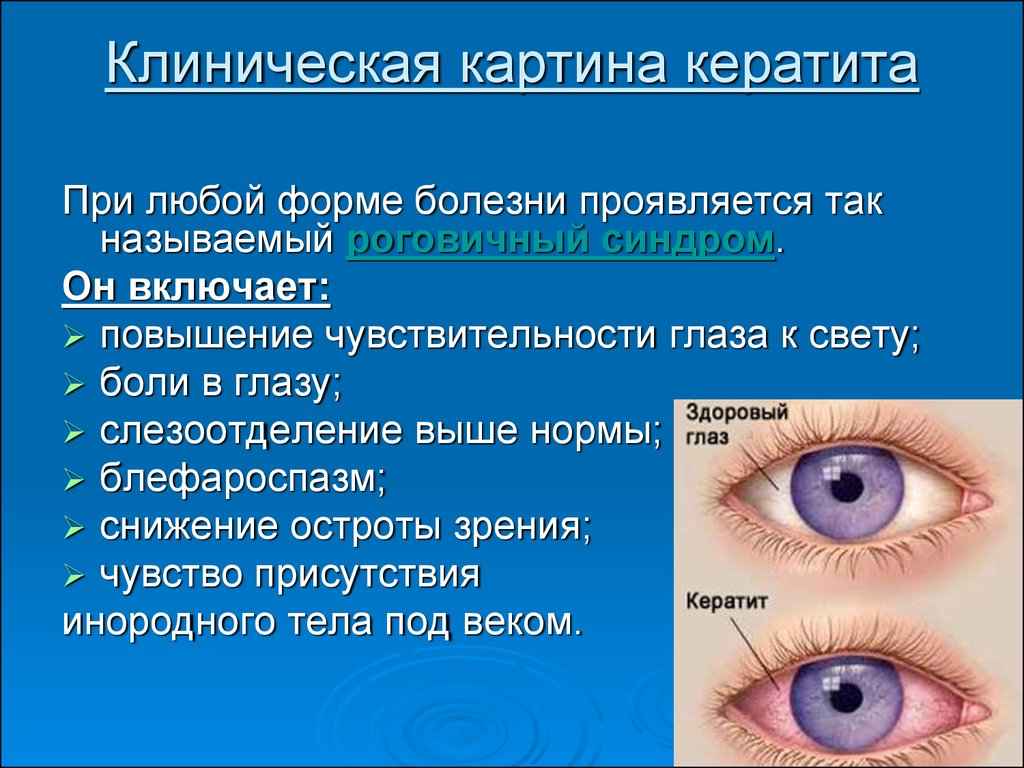 Глаза новорожденного ребенка гноятся - почему, чем лечить